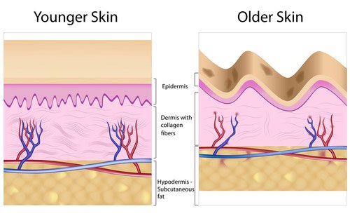 Causes of Age Spots